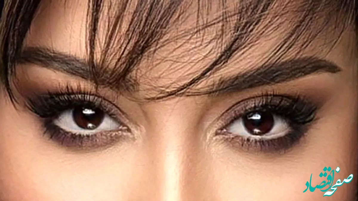 دختر بازیگر پیشکسوت بعد از عمل های زیبایی / عکس