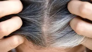 چگونه می توانیم از سفید شدن موی سر جلوگیری کنیم؟ 