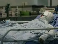 جزییات سوختن شدید مرد ۳۷ ساله هنگام شست‌وشوی قطعات موتورسیکلت با بنزین 