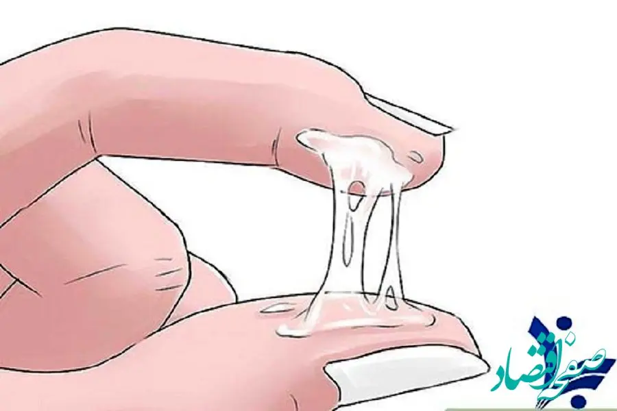 بیماری های زنان را ازتغییر ترشحات واژن تشخیص دهید