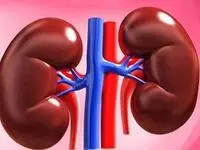 موثرترین و کاربردی ترین روش های دفع سنگ کلیه