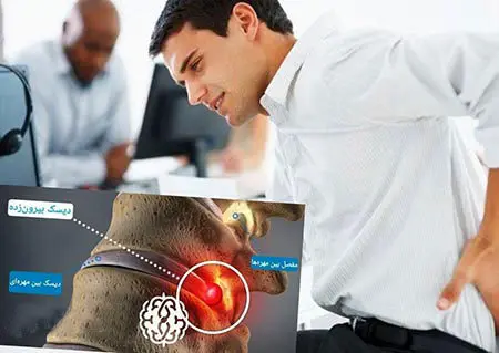 چرا دیسک کمر شما بیرون میزند؟ | پاسخهایی که نمیدانستید
