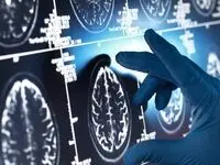این داروی گیاهی مفید علیه آلزایمر را بشناسید