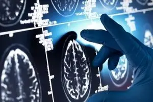 این داروی گیاهی مفید علیه آلزایمر را بشناسید
