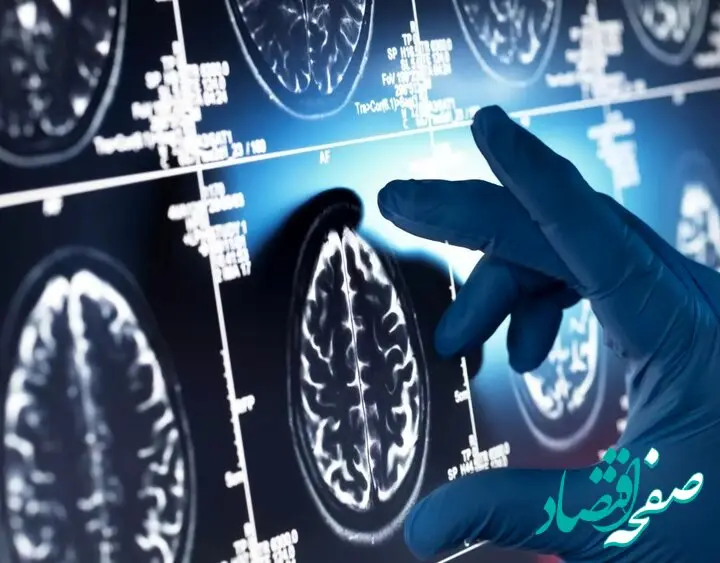 این داروی گیاهی مفید علیه آلزایمر را بشناسید