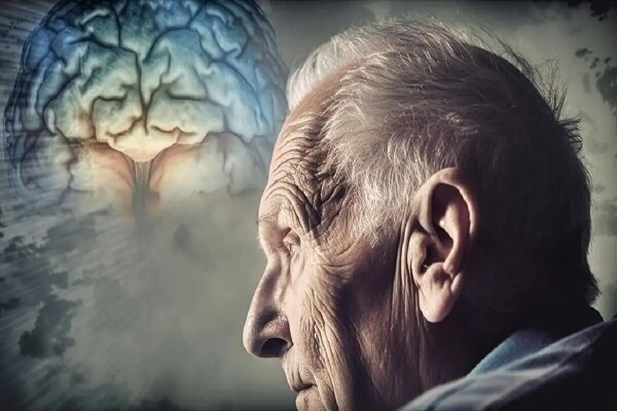 داروی جدید، تأخیر در شروع آلزایمر | موفقیت در پزشکی: آلزاییمر درمان شد!