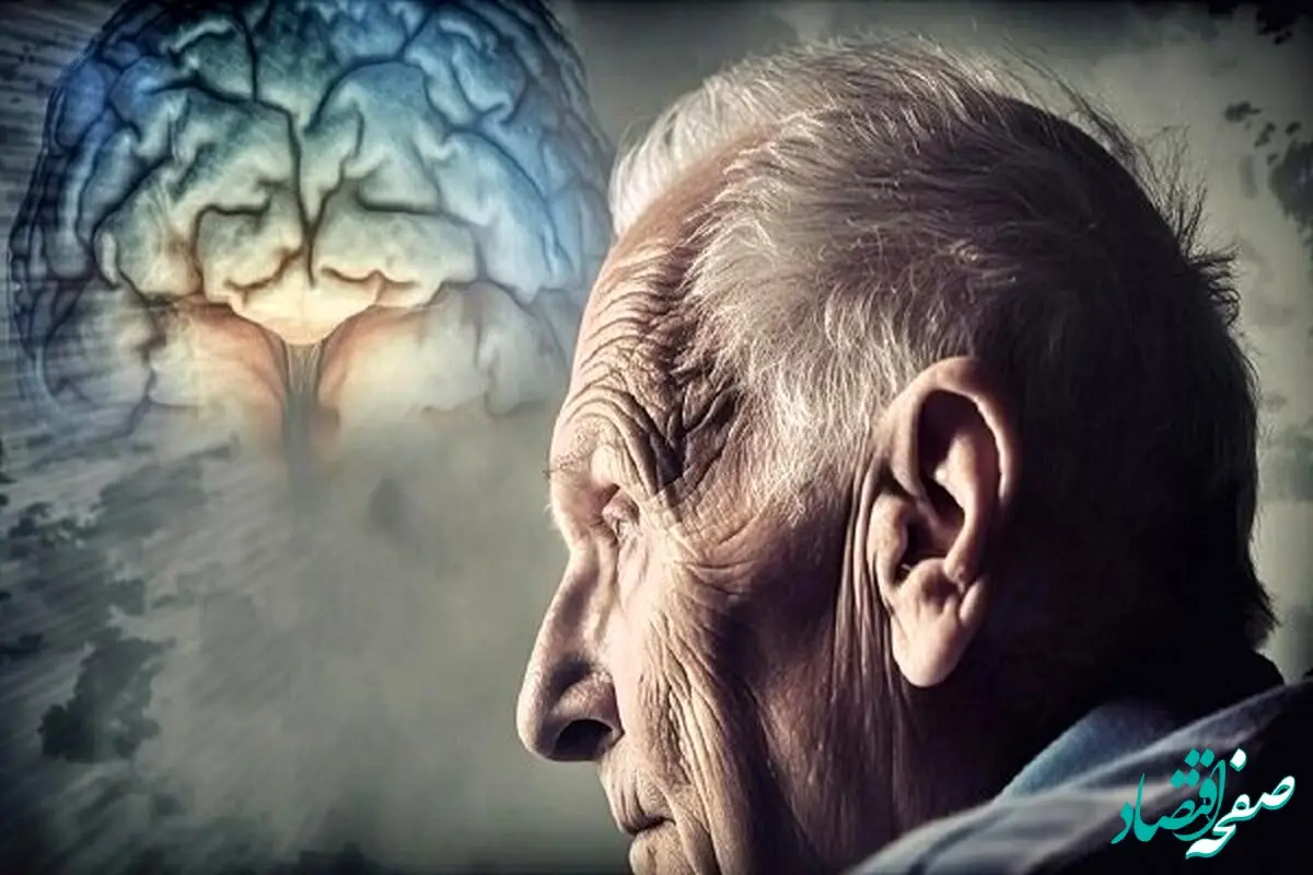 داروی جدید، تأخیر در شروع آلزایمر | موفقیت در پزشکی: آلزاییمر درمان شد!