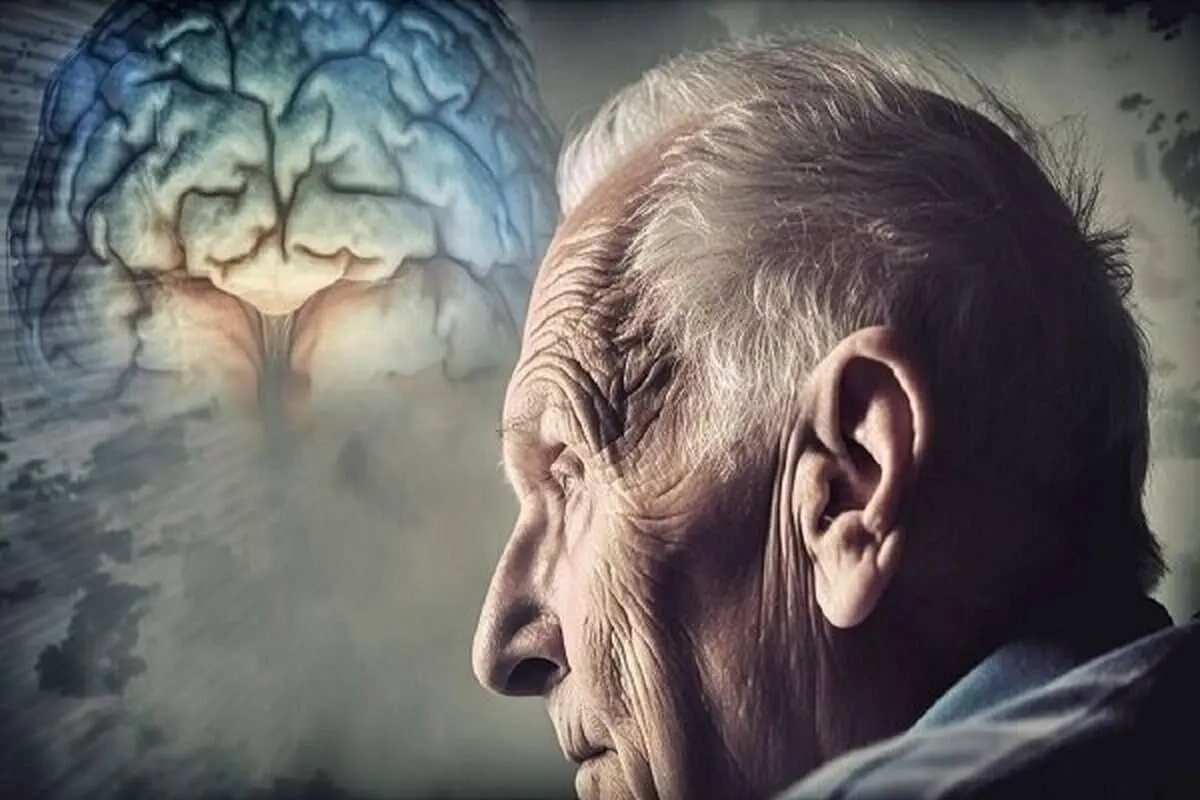 داروی جدید، تأخیر در شروع آلزایمر | موفقیت در پزشکی: آلزاییمر درمان شد!