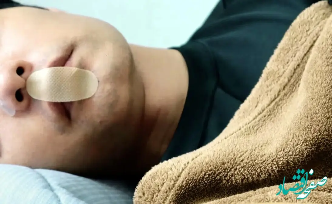 آیا حقیقت دارد با زدن چسب رو دهان بهتر می خوابیم؟