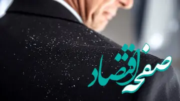 این سه راهکار جالب و ساده برای درمان خانگی شوره سر را حتما بخوانید