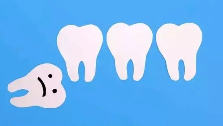 آیا باید حتما دندان عقل را بکشیم؟