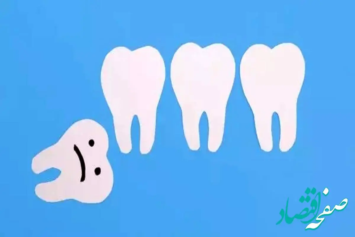 آیا باید حتما دندان عقل را بکشیم؟