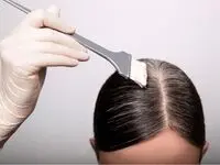 عوارض جدی رنگ کردن مکرر مو