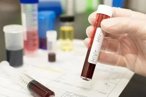 مقام وزارت بهداشت: تست HIV کاملاً رایگان و محرمانه است