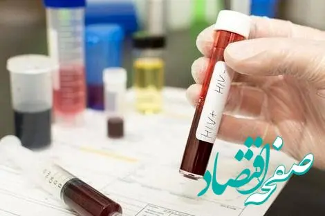 مقام وزارت بهداشت: تست HIV کاملاً رایگان و محرمانه است