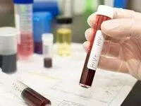 مقام وزارت بهداشت: تست HIV کاملاً رایگان و محرمانه است