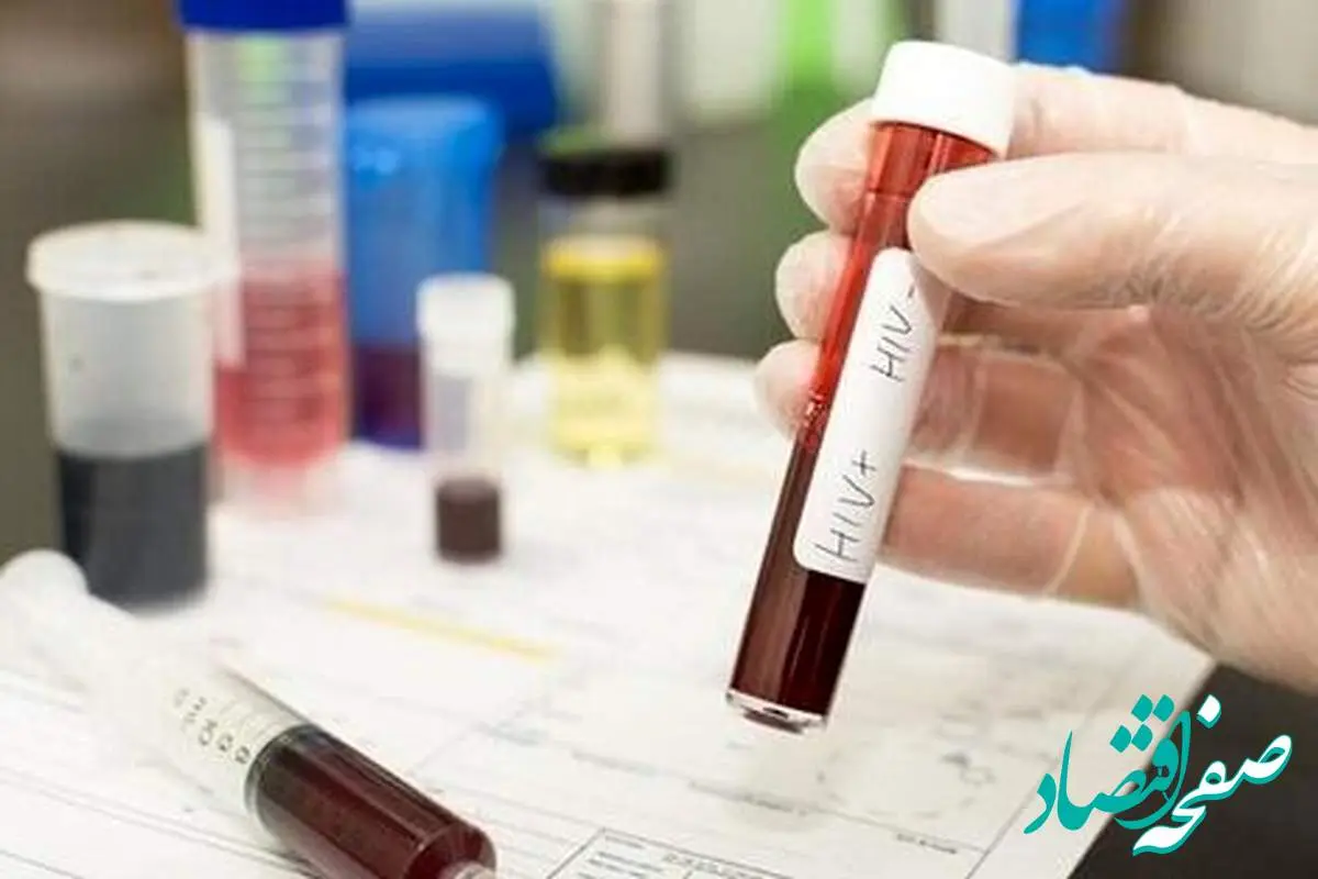 مقام وزارت بهداشت: تست HIV کاملاً رایگان و محرمانه است