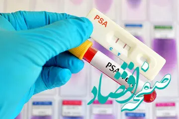 اقداماتی که برای انجام آزمایش پروستات لازم است