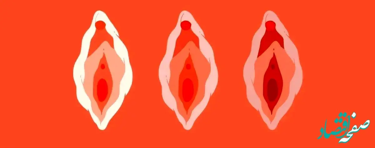 تورم لبهای کوچک واژن: از دلایل شایع تا درمانهای مؤثر