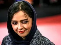 آخرین وضعیت جسمانی ترانه علیدوستی | منشا بیماری ترانه چیست؟ 