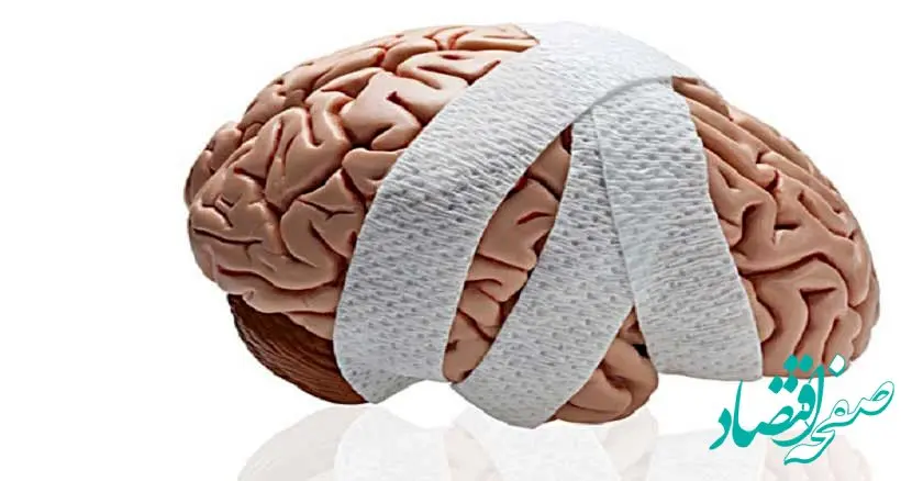 علائم سکته مغزی را بشناسید و با این روش از بروز آن پیشگیری کنید