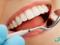 کاهش هزینه دندانپزشکی و سلامت دندان با پوشش دندانپزشکی بیمه تکمیلی