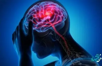چجوری با سکته مغزی مقابله کنیم؟ | همه چیز درباره سکته مغزی