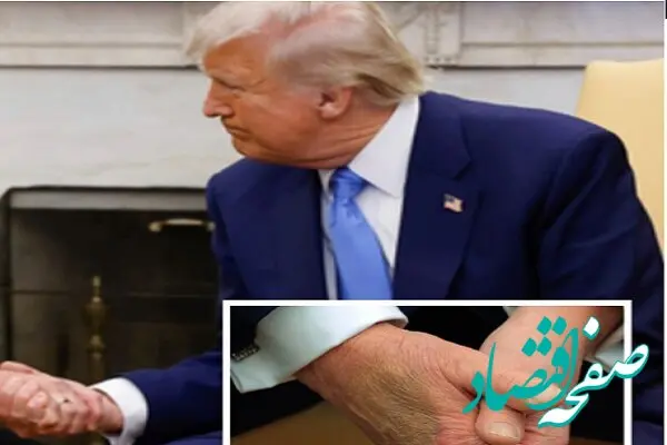دونالد ترامپ درد بی درمان گرفت؟! / بیماری لاعلاج ترامپ چیست؟ 
