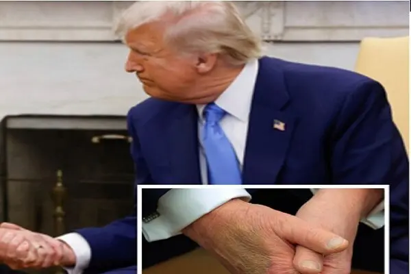 دونالد ترامپ درد بی درمان گرفت؟! / بیماری لاعلاج ترامپ چیست؟