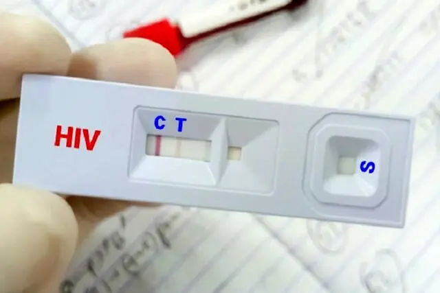 آیا حقیقت دارد درمان بیماری ایدز رایگان است؟ 