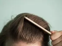 چطور در ۳۰ روز رشد سریع مو داشته باشیم؟ + راهنمای علمی با نکات طلایی