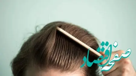 چطور در ۳۰ روز رشد سریع مو داشته باشیم؟ + راهنمای علمی با نکات طلایی