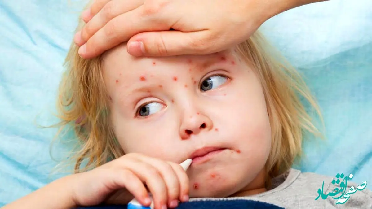 بخوانید | این افراد به مراقبت بیشتر در برابر سرخک نیاز دارند!