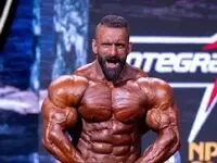  هادی چوپان چقدر خرج بدنش کرده؟ + جزئیات دقیق