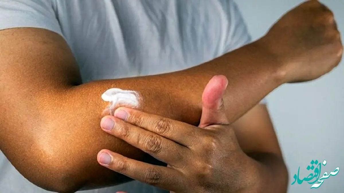 آیا کسانی که پوست تیره دارند هم باید حتما از ضدآفتاب استفاده کنند؟