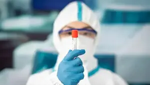 ماجرای طاعون در روسیه چقدر جدی است؟ + آخرین خبرها از شیوع طاعون