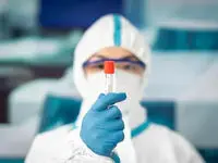 ماجرای طاعون در روسیه چقدر جدی است؟ + آخرین خبرها از شیوع طاعون