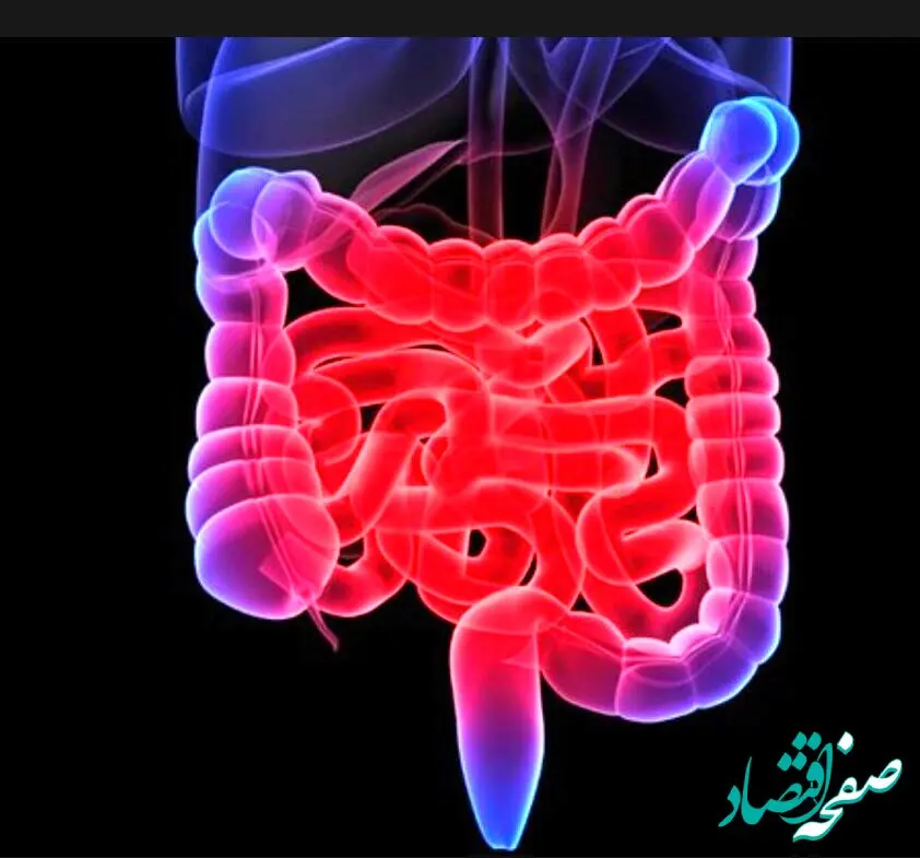 این ۵ خوراکی بشدت برای سلامت روده مضر است