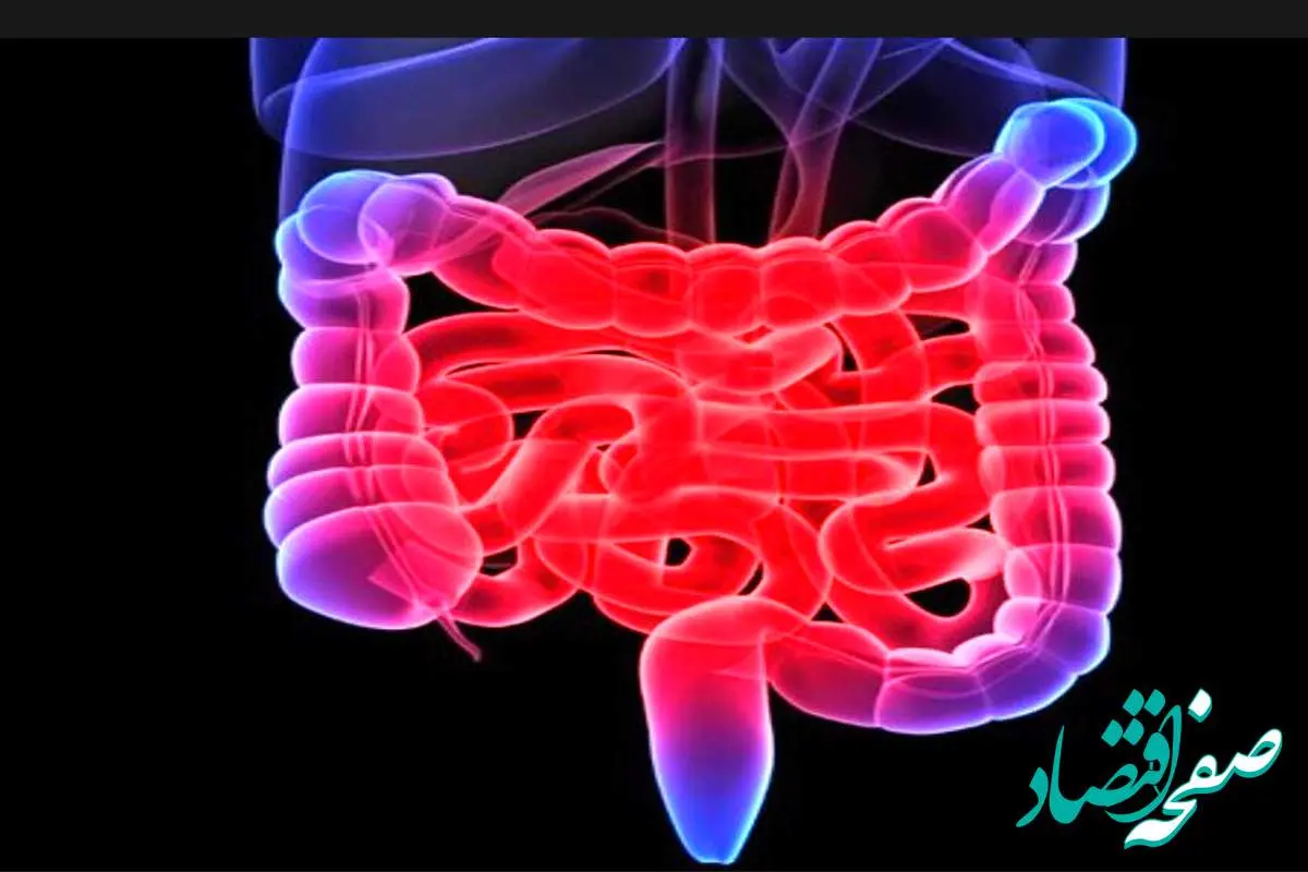 این ۵ خوراکی بشدت برای سلامت روده مضر است
