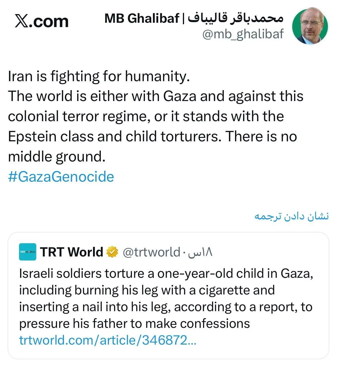 واکنش قالیباف به شکنجه وحشتناک کودک یکساله اهل غزه توسط سربازان وحشی اسراییلی