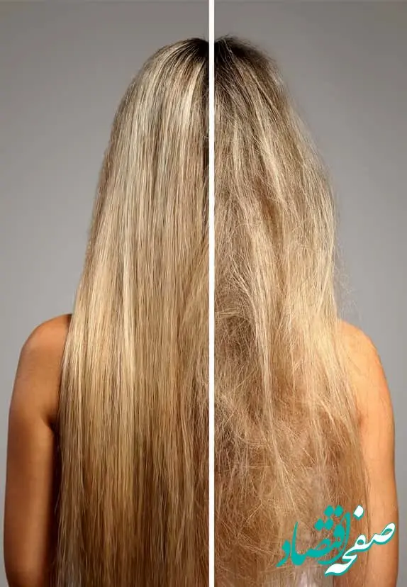 علت وز شدم موی خانم ها چیست؟