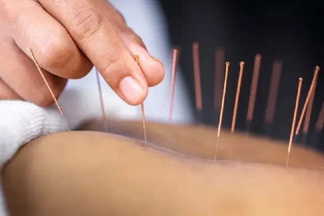 چگونه طب سوزنی به بازیابی صدای بیماران سکته مغزی کمک می کند؟ 