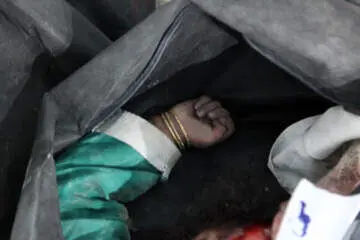 شهادت دردناک چند ژیمناست کار خردسال در حمله آمریکا و اسرائیل به مدرسه میناب + تصویر