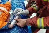 جزییات حادثه برای دست کودک دو ساله اعلام شد