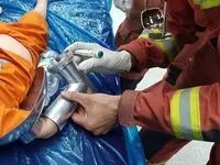 جزییات حادثه برای دست کودک دو ساله اعلام شد