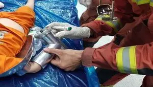 جزییات حادثه برای دست کودک دو ساله اعلام شد