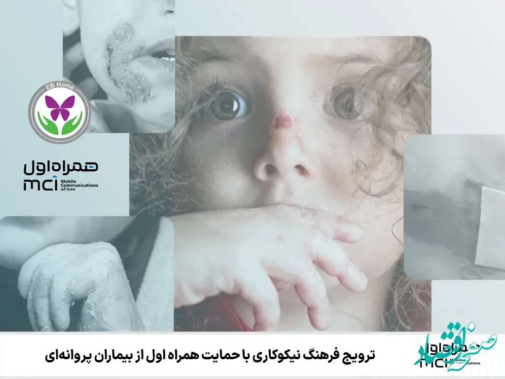 ترویج فرهنگ نیکوکاری با حمایت همراه اول از بیماران پروانه‌ای