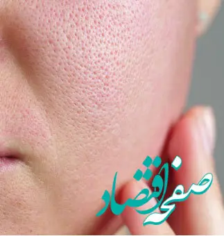 با این روش منافذ باز پوست را کوچک تر کنید