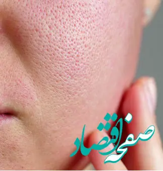 با این روش منافذ باز پوست را کوچک تر کنید