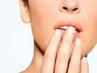 راه های درمان و پیشگیری از ویروس های HPV و HSV
